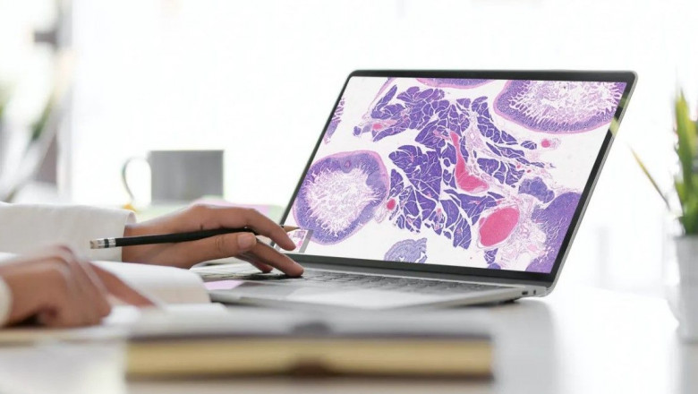 AI-based Digital Pathology Market Size, Trends, and Growth Strategies Analysis