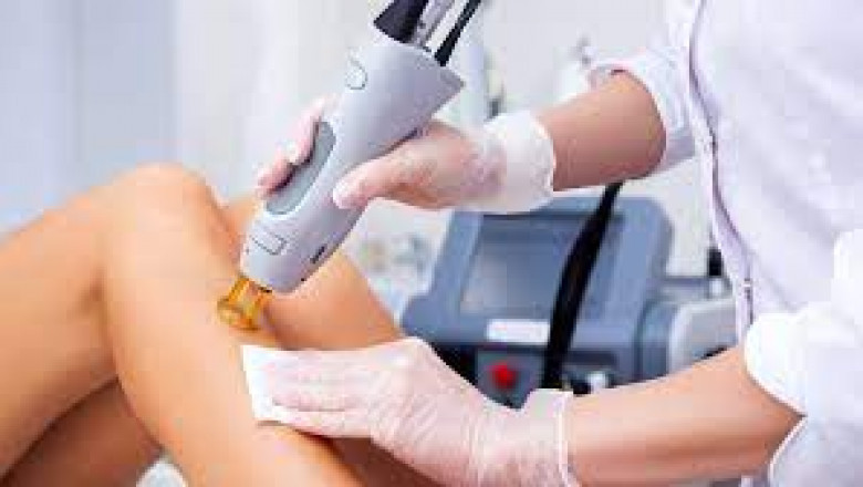 How Much Time Is Needed Between Laser Sessions?