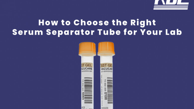 How to Choose the Right Serum Separator Tube for Your Lab