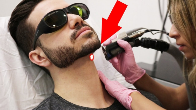 Is Chest Male Laser Hair Removal Cost Expensive?