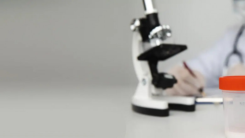 Semen Analysis Report : How to Read a Sperm Analysis Report