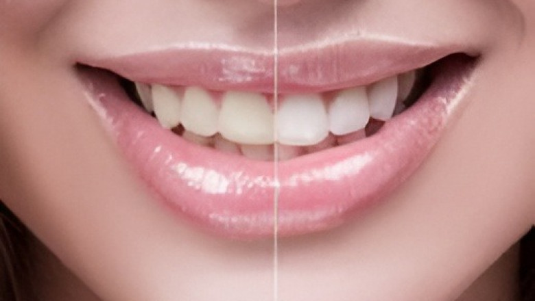 Your Trusted Dentist in Northridge for Complete Family and Cosmetic Care
