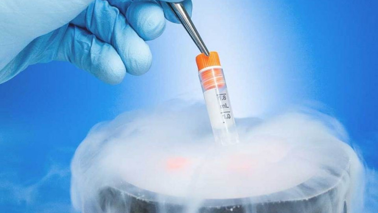 Fertility Preservation in Gachibowli | Hyderabad - Dr Sravya Buggana