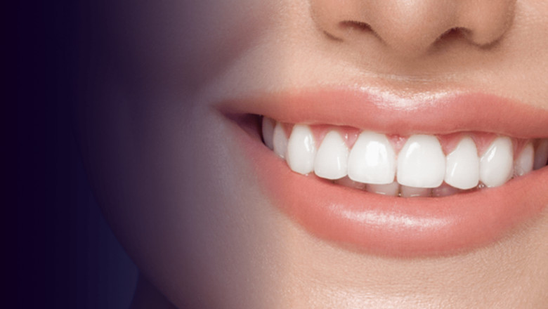 How to Choose a Whitening Option by Budget