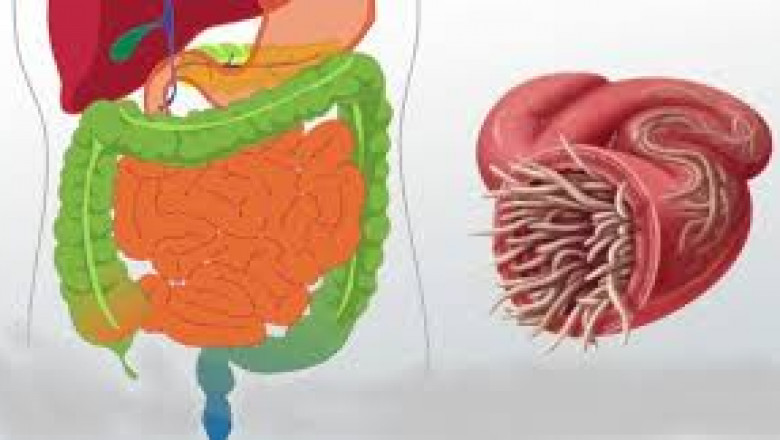 The Malabsorption Syndrome industry is evolving rapidly with innovative diagnostic