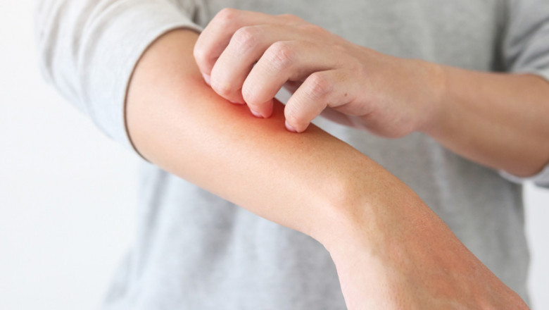 Acute Bacterial Skin And Skin Structure Infections Treatment Market Growth Analysis