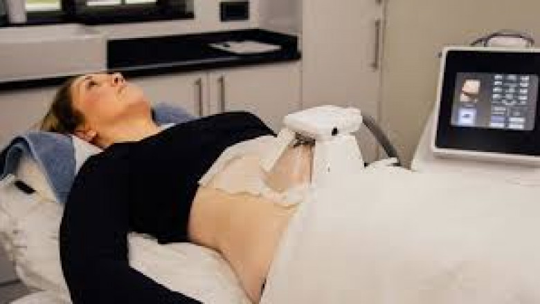 Affordable FAT REMOVAL TREATMENT Islamabad: Options That Work