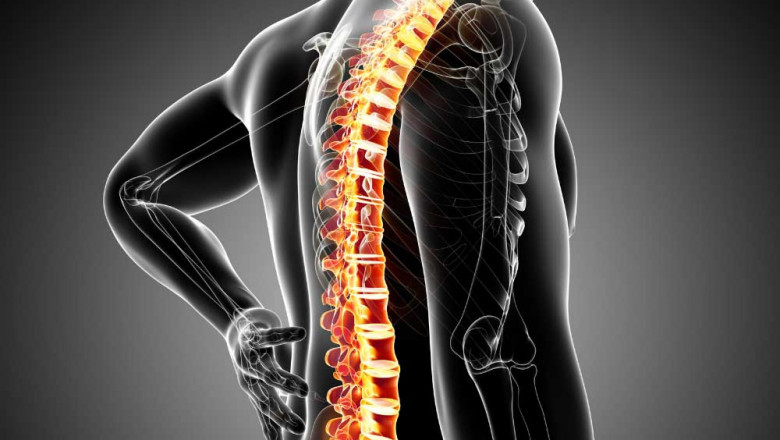Axial Spondyloarthritis Market Size, Trends, and Strategic Outlook 2025-2032