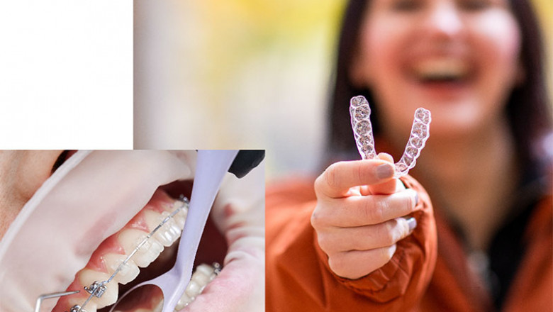Dental Implants in Mumbai - NR Dental Clinic