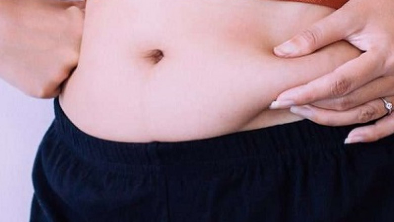 Liposuction Weight Loss – Where Fat Meets Its Match