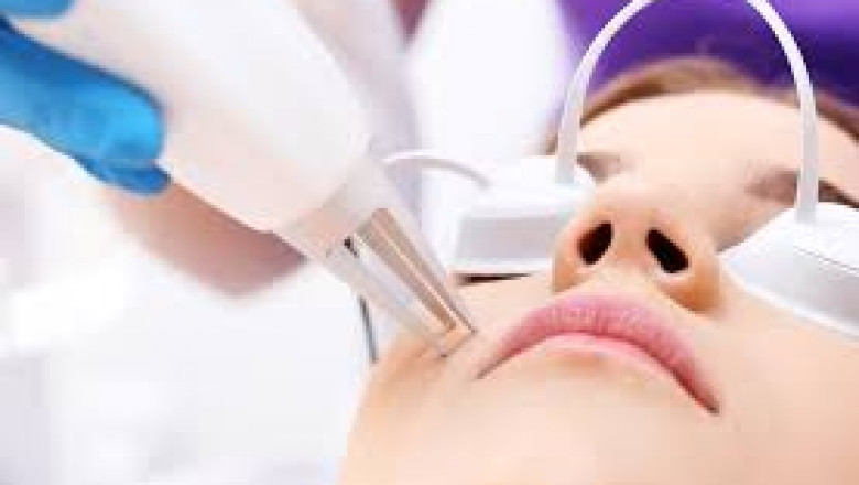 Can Lasers Help With Skin Pigmentation Issues?
