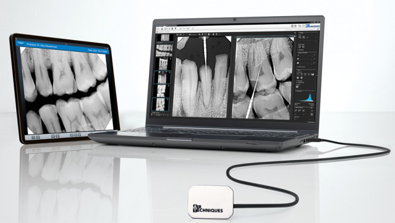 Implante dental