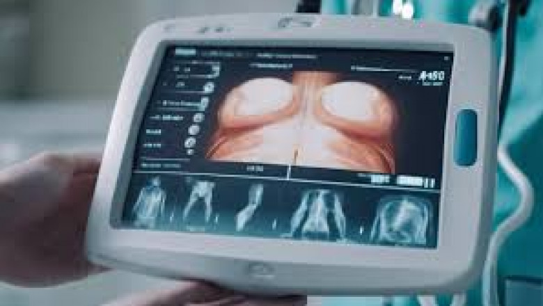 Portable Ultrasound Bladder Scanner Market Analysis Reveals Emerging Opportunities in Asia-Pacific Healthcare Landscape