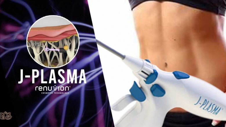 Skin Tightening in NYC with Renuvion &amp; J-Plasma