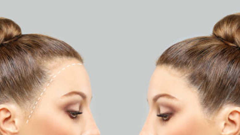 أفضل مراكز زراعة الشعر في الرياض لتحقيق نتائج طبيعية