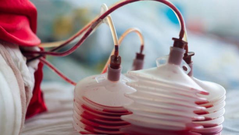 Global Surgical Drainage Devices Market Size, Share, Analysis and Forecast 2021 – 2030