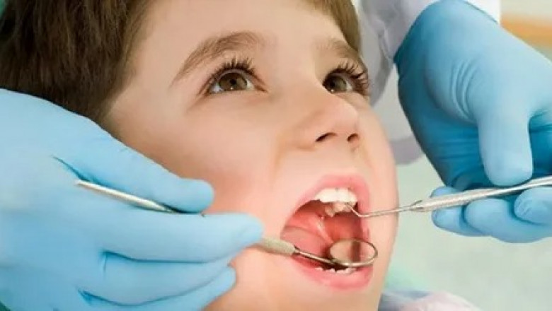 Gentle Restorative Dental Care for Kids Houston