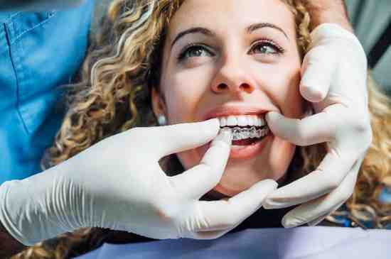 Invisalign Newcastle