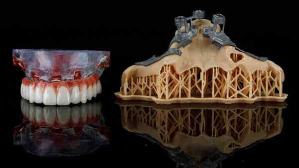 Dental implants in Stevenage