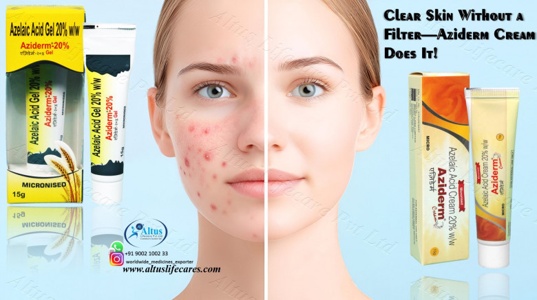 Azelaic Gel 20%: The Secret to Your Best Skin Ever!