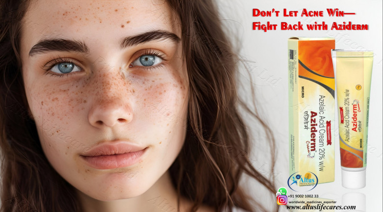 Aziderm 20 Cream: The Ultimate Solution for Beautiful Skin!