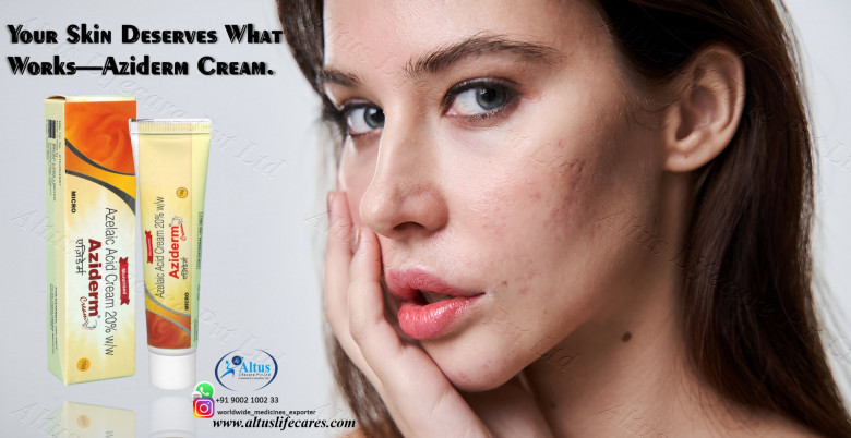 Aziderm 20 Cream: The Ultimate Solution for Beautiful Skin!