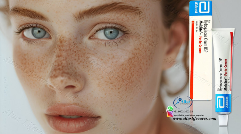 Hydroquinone Cream for Flawless Skin: Your Key to a Stunning Complexion! 