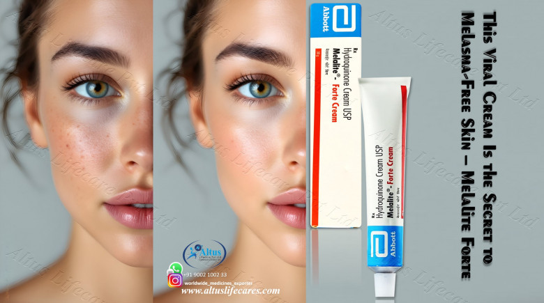 Hydroquinone Cream for Flawless Skin: Your Key to a Stunning Complexion! 