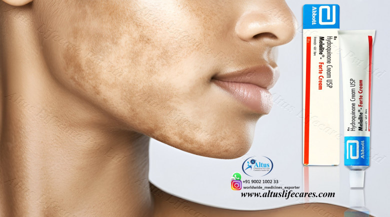 Hydroquinone Cream for Flawless Skin: Your Key to a Stunning Complexion! 