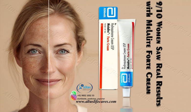 Hydroquinone Cream for Flawless Skin: Your Key to a Stunning Complexion! 