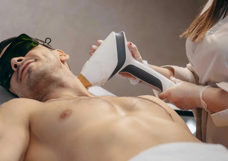 Male Laser Hair Removal Cost in Dubai