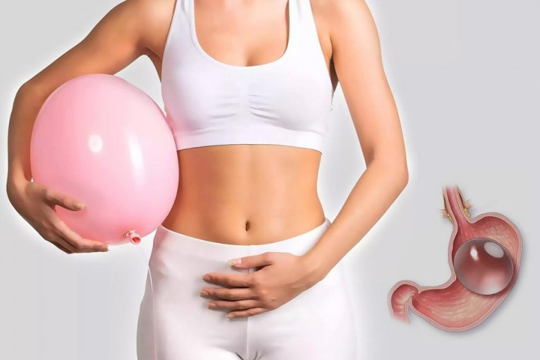 Gastric Balloon Placement in Dubai