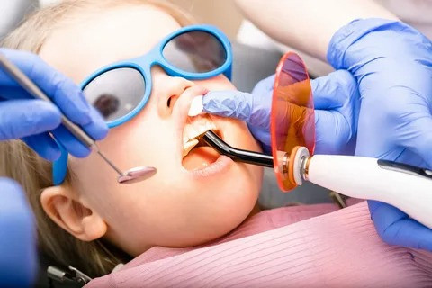 Tooth-colored dental fillings for children in Houston