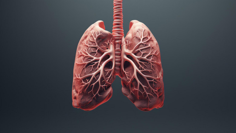 MAC Lung Disease Therapeutics: Market Growth and Competitive Landscape