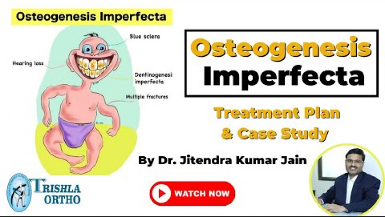 ओस्टियोजेनेसिस इम्परफेक्टा (भंगुर हड्डी रोग): उपचार और मामले की रिपोर्ट | Trishla Ortho