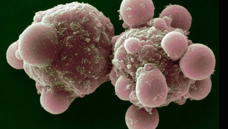 The Apoptosis Market will grow at highest pace owing to rising cancer incidence