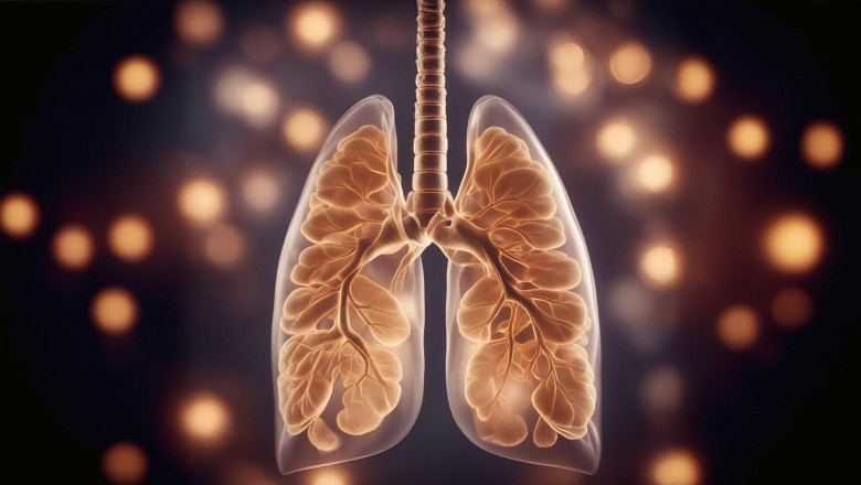 Forecasting the Bronchiectasis Market Trends and Challenges