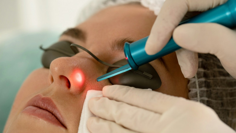 5 Things That Influence the Cost of Laser Treatments in Dubai