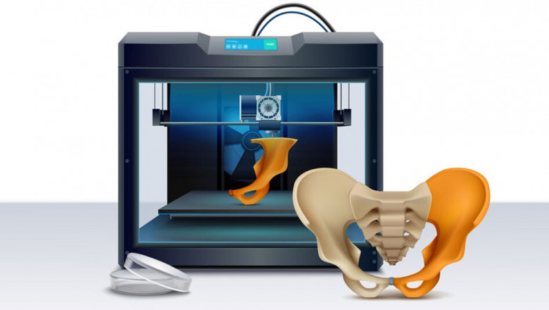 Next-Gen Orthopaedic Surgery - Innovations in 3D Printing and Robotics