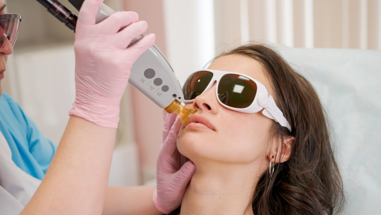 Get Rid of Acne Scars with Pico Laser: Here’s How