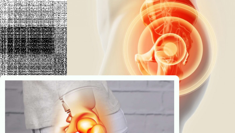 Ortho Center Pakistan – Leading Hip Replacement in Lahore