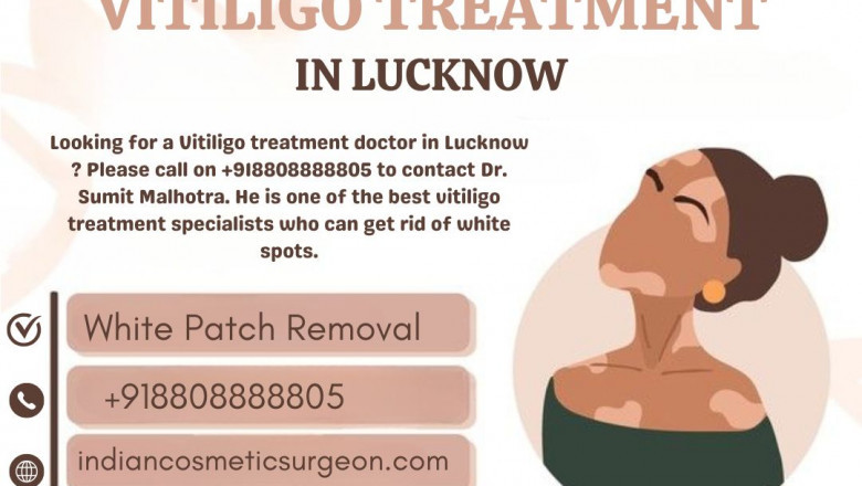 When Should You Seek Vitiligo Treatment in Lucknow?