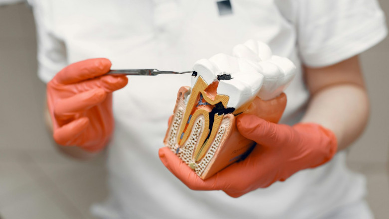 Top Dental Services Offered by a Dentist in Parker