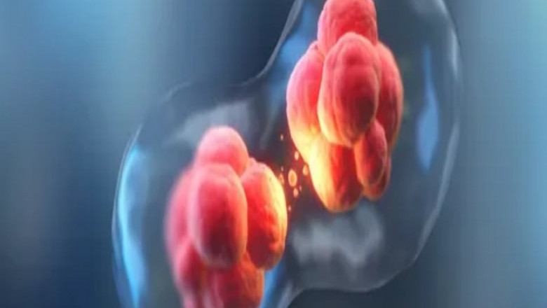 Cell Separation: Methods, Applications, and Advancements