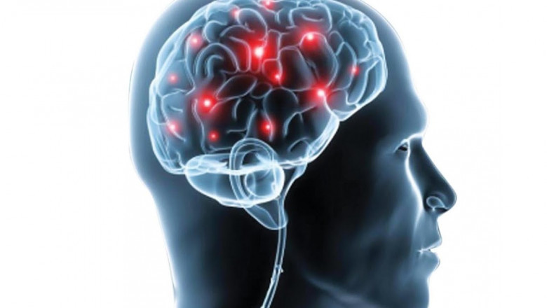 Arteriovenous Malformations Market Will Grow At Highest Pace Owing To Increased Adoption Of Minimal Invasive Techniques