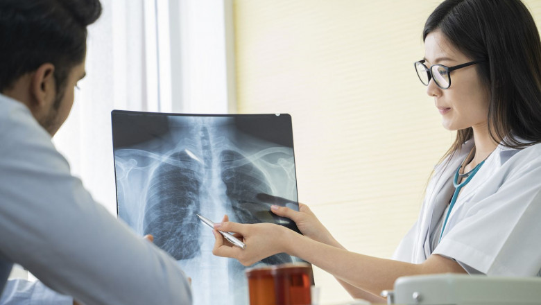 Bronchiolitis Obliterans Syndrome Market will grow at highest pace owing to technological advancement in diagnosis and treatment