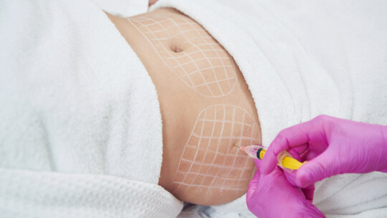 The Pros and Cons of Fat-Dissolving Injections in Dubai