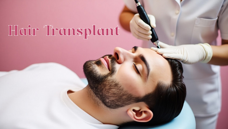 Hair Transplant In Agra