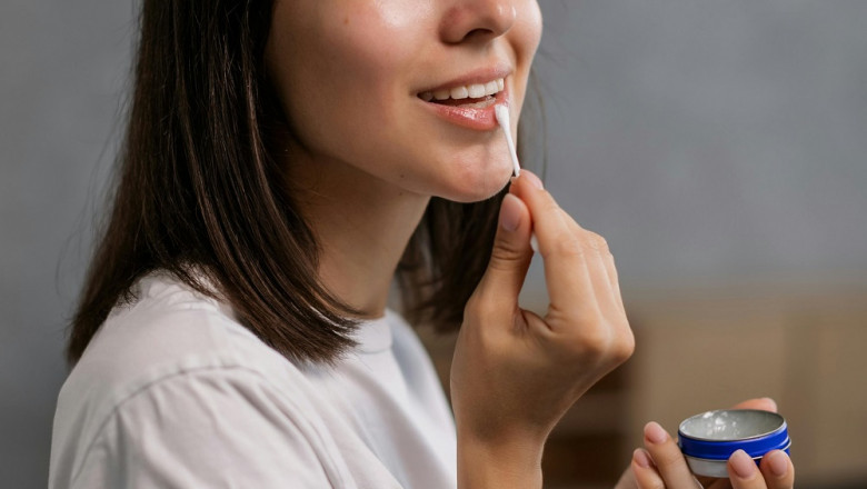 Lip Pigmentation Removal in Bangalore – Restore Your Natural Beauty at Sculpt The Maxillofacial Clinic