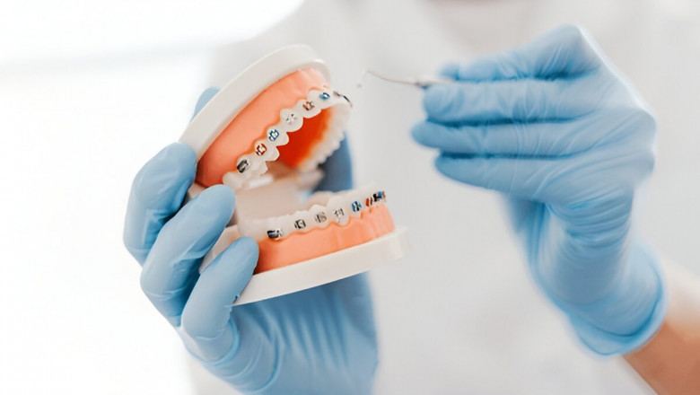 Orthodontist Massapequa NY